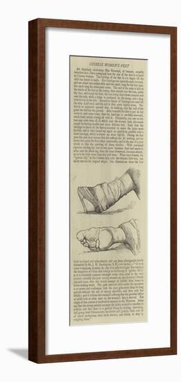 Chinese Women's Feet-null-Framed Giclee Print