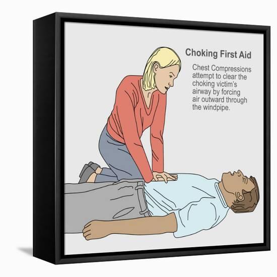 Choking First Aid-Gwen Shockey-Framed Stretched Canvas