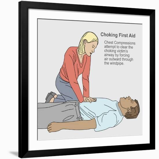 Choking First Aid-Gwen Shockey-Framed Giclee Print