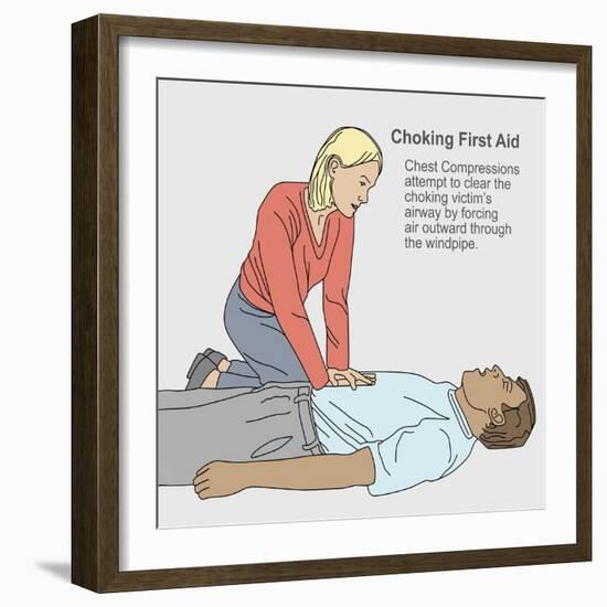 Choking First Aid-Gwen Shockey-Framed Giclee Print