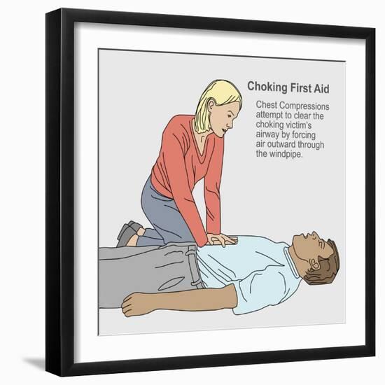 Choking First Aid-Gwen Shockey-Framed Giclee Print