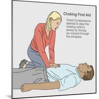 Choking First Aid-Gwen Shockey-Mounted Giclee Print