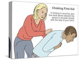 Choking First Aid-Gwen Shockey-Stretched Canvas