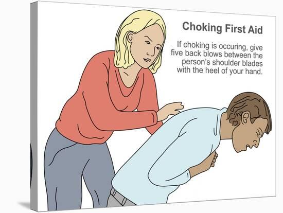 Choking First Aid-Gwen Shockey-Stretched Canvas