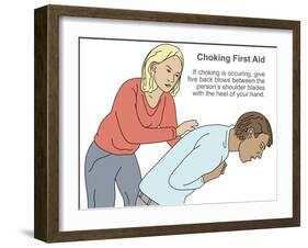 Choking First Aid-Gwen Shockey-Framed Giclee Print