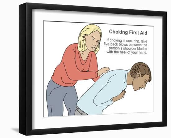 Choking First Aid-Gwen Shockey-Framed Giclee Print