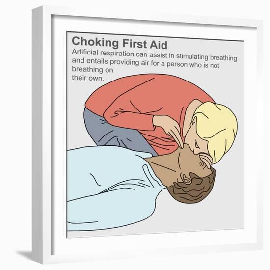 Choking First Aid-Gwen Shockey-Framed Giclee Print