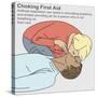 Choking First Aid-Gwen Shockey-Stretched Canvas