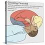 Choking First Aid-Gwen Shockey-Stretched Canvas