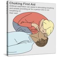 Choking First Aid-Gwen Shockey-Stretched Canvas
