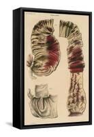 Cholera Infected Intestines, 1808-Science Source-Framed Stretched Canvas