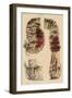 Cholera Infected Intestines, 1808-Science Source-Framed Giclee Print