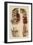 Cholera Infected Intestines, 1808-Science Source-Framed Giclee Print