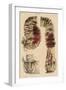 Cholera Infected Intestines, 1808-Science Source-Framed Giclee Print