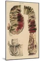 Cholera Infected Intestines, 1808-Science Source-Mounted Giclee Print