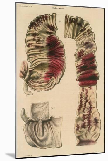 Cholera Infected Intestines, 1808-Science Source-Mounted Giclee Print