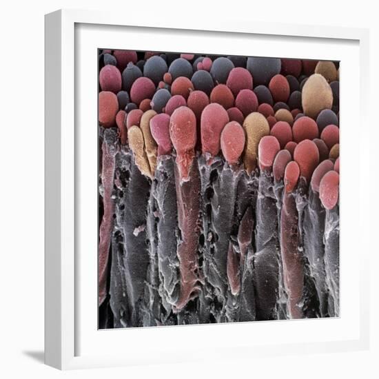 Choroid Plexus Secretory Cells, SEM-Steve Gschmeissner-Framed Premium Photographic Print