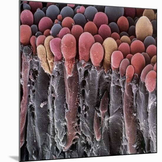 Choroid Plexus Secretory Cells, SEM-Steve Gschmeissner-Mounted Photographic Print