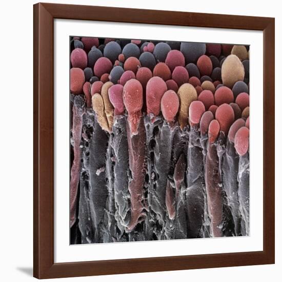 Choroid Plexus Secretory Cells, SEM-Steve Gschmeissner-Framed Photographic Print