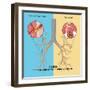 Chronic Obstructive Pulmonary Disease (COPD)-Monica Schroeder-Framed Giclee Print