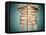 Close-Up View of Human Rib Cage-null-Framed Stretched Canvas