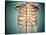 Close-Up View of Human Rib Cage-null-Stretched Canvas