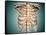 Close-Up View of Human Rib Cage-null-Framed Stretched Canvas