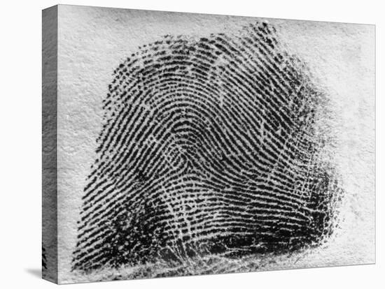 Closeup of Fingerprint of a Teenage Girl Who Is a Twin-null-Stretched Canvas