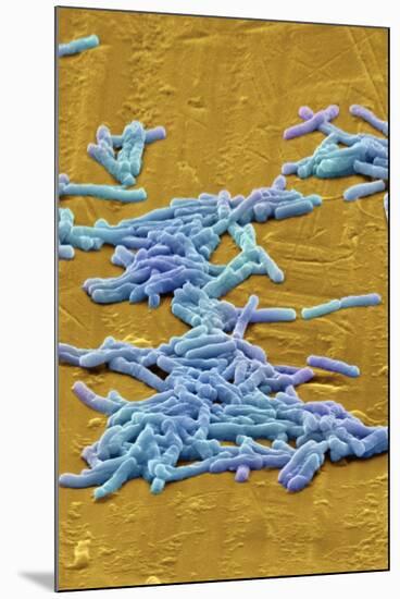 Clostridium Difficile Bacteria, SEM-David McCarthy-Mounted Photographic Print