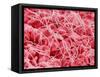 Coagulated Human Red Blood Cells-Micro Discovery-Framed Stretched Canvas