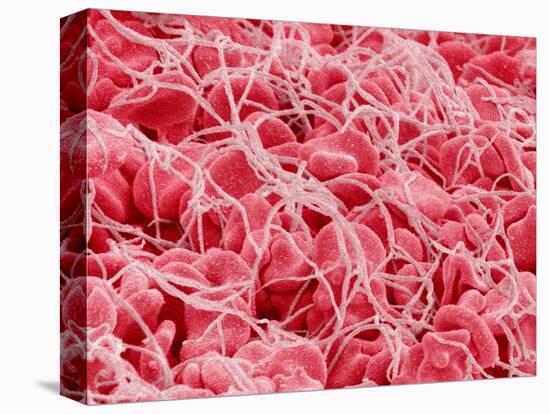 Coagulated Human Red Blood Cells-Micro Discovery-Stretched Canvas