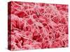 Coagulated Human Red Blood Cells-Micro Discovery-Stretched Canvas