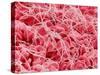 Coagulated Human Red Blood Cells-Micro Discovery-Stretched Canvas