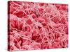 Coagulated Human Red Blood Cells-Micro Discovery-Stretched Canvas