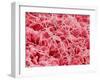 Coagulated Human Red Blood Cells-Micro Discovery-Framed Premium Photographic Print