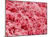 Coagulated Human Red Blood Cells-Micro Discovery-Mounted Premium Photographic Print