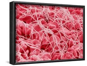 Coagulated Human Red Blood Cells-Micro Discovery-Framed Photographic Print