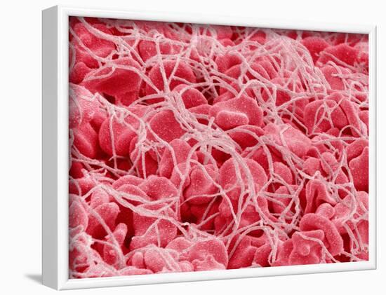 Coagulated Human Red Blood Cells-Micro Discovery-Framed Photographic Print