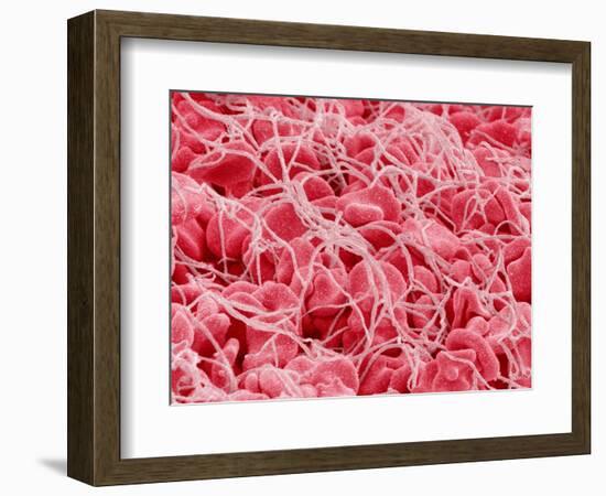 Coagulated Human Red Blood Cells-Micro Discovery-Framed Photographic Print