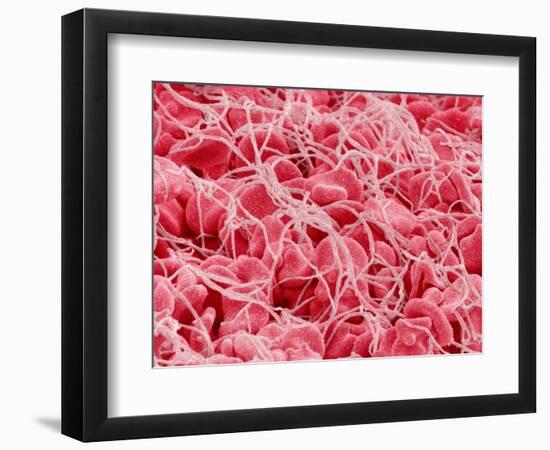 Coagulated Human Red Blood Cells-Micro Discovery-Framed Photographic Print