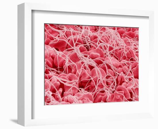 Coagulated Human Red Blood Cells-Micro Discovery-Framed Photographic Print