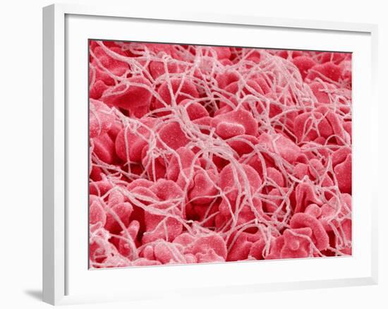 Coagulated Human Red Blood Cells-Micro Discovery-Framed Photographic Print