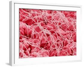 Coagulated Human Red Blood Cells-Micro Discovery-Framed Photographic Print