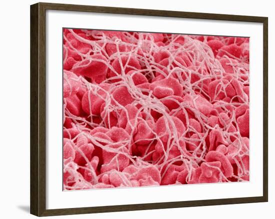 Coagulated Human Red Blood Cells-Micro Discovery-Framed Photographic Print