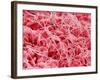Coagulated Human Red Blood Cells-Micro Discovery-Framed Photographic Print