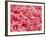 Coagulated Human Red Blood Cells-Micro Discovery-Framed Photographic Print