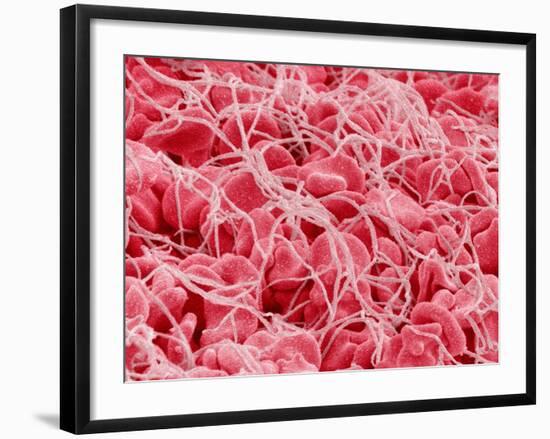 Coagulated Human Red Blood Cells-Micro Discovery-Framed Photographic Print