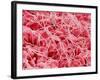 Coagulated Human Red Blood Cells-Micro Discovery-Framed Photographic Print