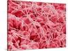 Coagulated Human Red Blood Cells-Micro Discovery-Stretched Canvas