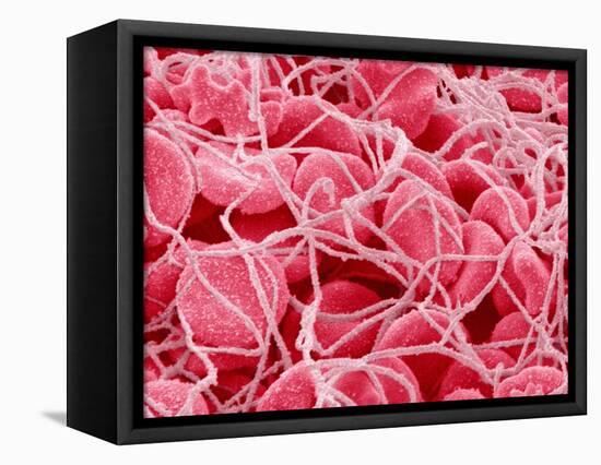 Coagulated Red Blood Cells-Micro Discovery-Framed Stretched Canvas
